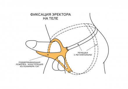 Телесный эректор-ложечка с фиксацией на ремешках MEN STYLE 